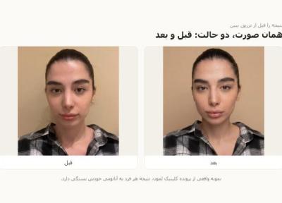 قبل از تزریق، نتیجه را ببینیم؟ کاری که هوش مصنوعی در مشاوره زیبایی می تواند بکند و کاری که نمی تواند